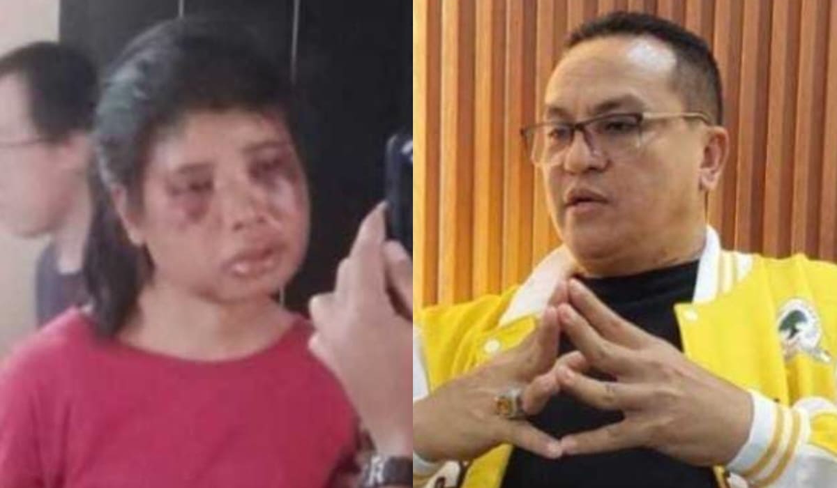 Anggota Komisi XIII DPR RI dari Fraksi Partai Golkar, Dr. Umbu Rudi Kabunang, mengecam keras aksi kekerasan yang dialami seorang Asisten Rumah Tangga (ART) asal Nusa Tenggara Timur (NTT) bernama Intan, di Batam, Kepulauan Riau.